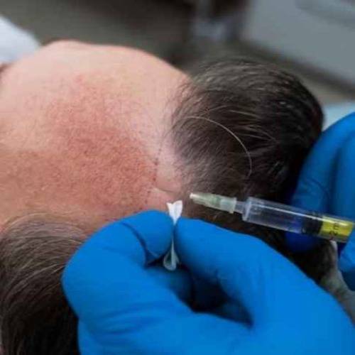 Advanced Hair Restoration and Aesthetic Solutions at Dr Aggarwal Clinic Trusted Care in Jaipur and Jodhpur