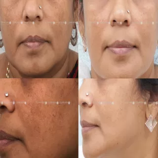 Anti Ageing Treatment Clinic in Baran