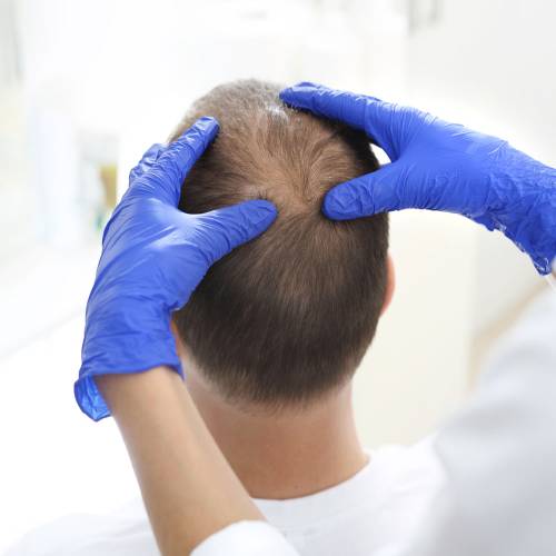 Autologous Micrograft Treatment Clinic in Degana