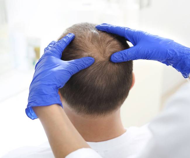 Autologous Micrograft Treatment Clinic in Jodhpur