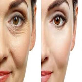 Botox Treatment Clinic in Baran