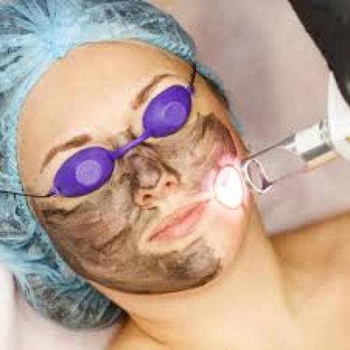 Carbon Laser Facial Treatment Clinic in Abu Road
