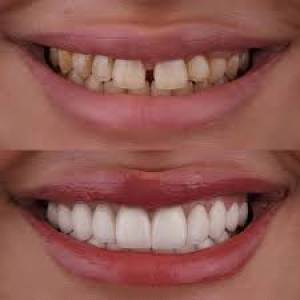 Cosmetic Dentistry Clinic in Jodhpur