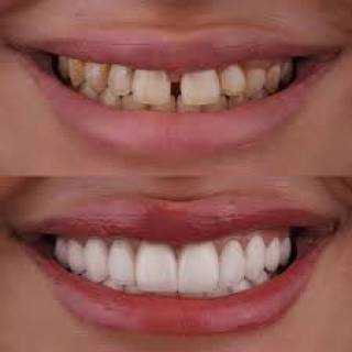 Cosmetic Dentistry Clinic in Jayal