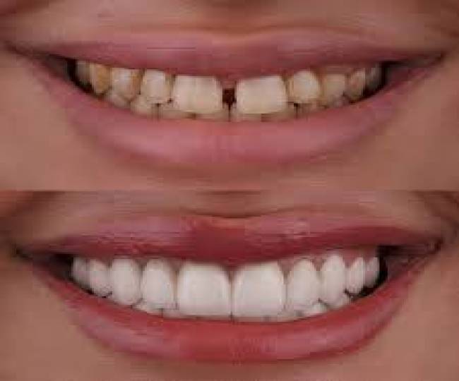 Cosmetic Dentistry Clinic in Jodhpur