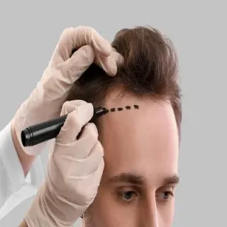 Hair Transplant Techniques Clinic in Karauli