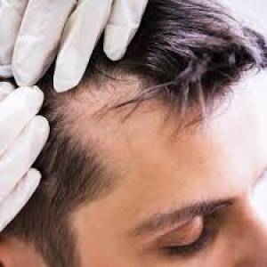 Laser Hair Therapy Clinic in Jodhpur