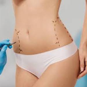 Liposuction Surgery Clinic in Jodhpur