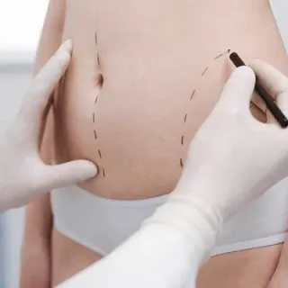 Nonsurgical Fat Reduction Clinic in Banswara