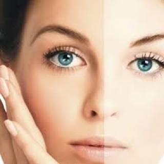 Pigmentation & Skin Whitening Clinic in Baran