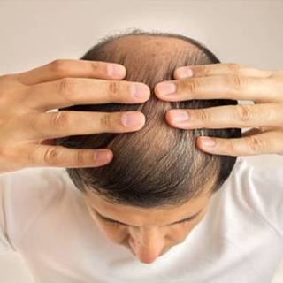 Sapphire FUE Hair Transplant Clinic in Ganganagar