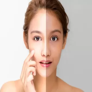 Skin Lightening Treatment Clinic in Baran