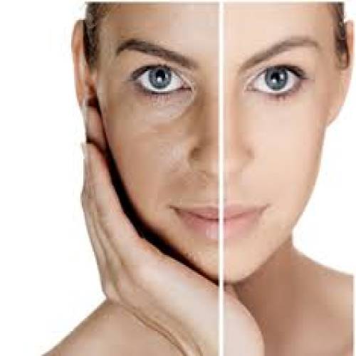 Skin Polishing Treatment Clinic in Behror